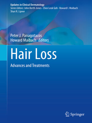 cover image of Hair Loss